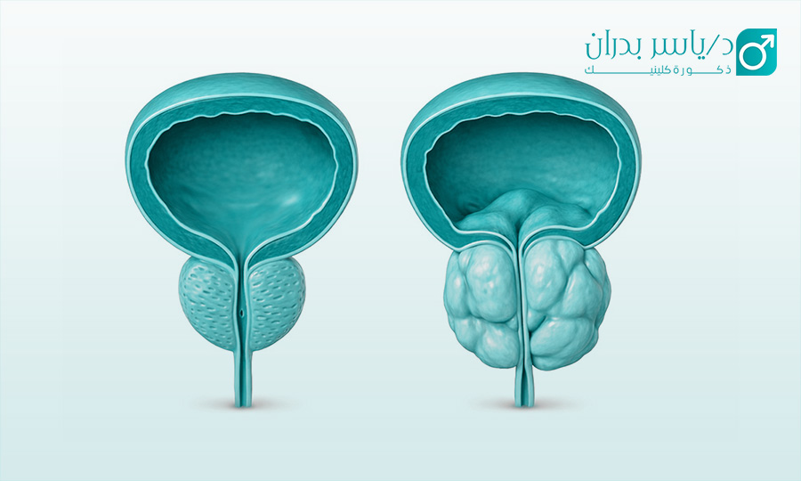 تحليل البروستاتا  اين توجد البروستاتا