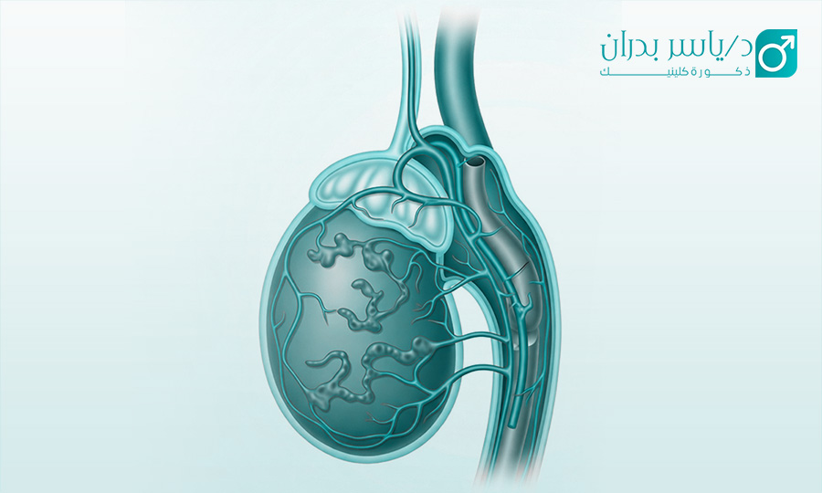 اشكال دوالي الخصية